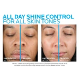 Untreated vs treated face comparison for shine control on two skin tones