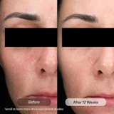 Revision D.E.J. Daily Boosting Serum