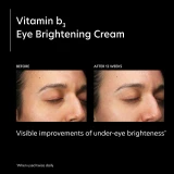 Before and after under-eye photos at 12 weeks