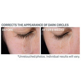 Before and after 8 weeks photos of the under-eye area