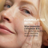 Woman touching her cheek, formulated with niacinamide to reduce redness text