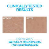 Before and after close-up photos of skin texture