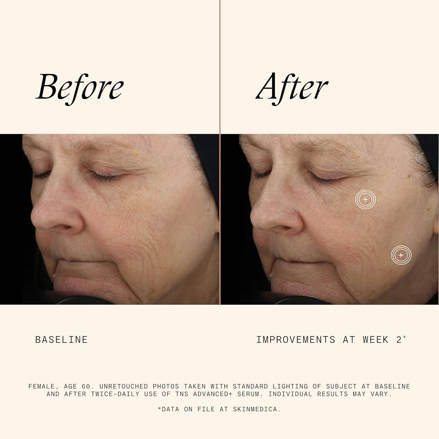 Premiere Serum Mask10枚　箱無し➕業務用ボディーパック2本 Premiere Serum Mask10枚 箱無し➕業務用ボディーパック2本