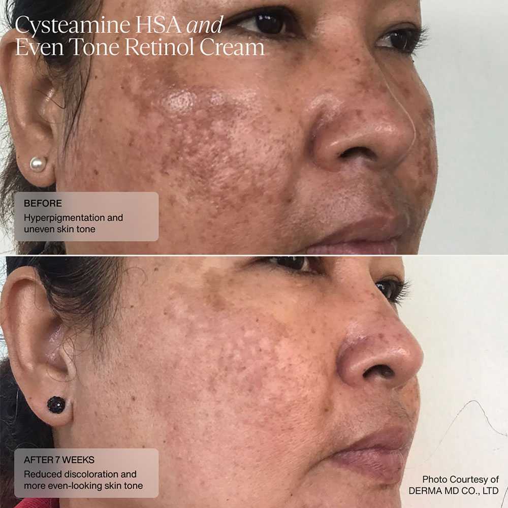 美容液 CQT.CQ3.CQC+ Chromatics Developer 20 Volume: Enhance Hair Color | Redken