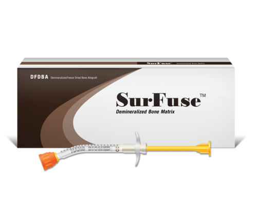 SurFuse Allograft Bone Putty