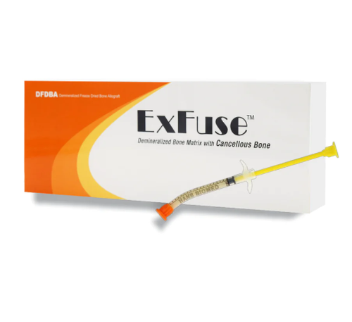 ExFuse Allograft Bone Putty