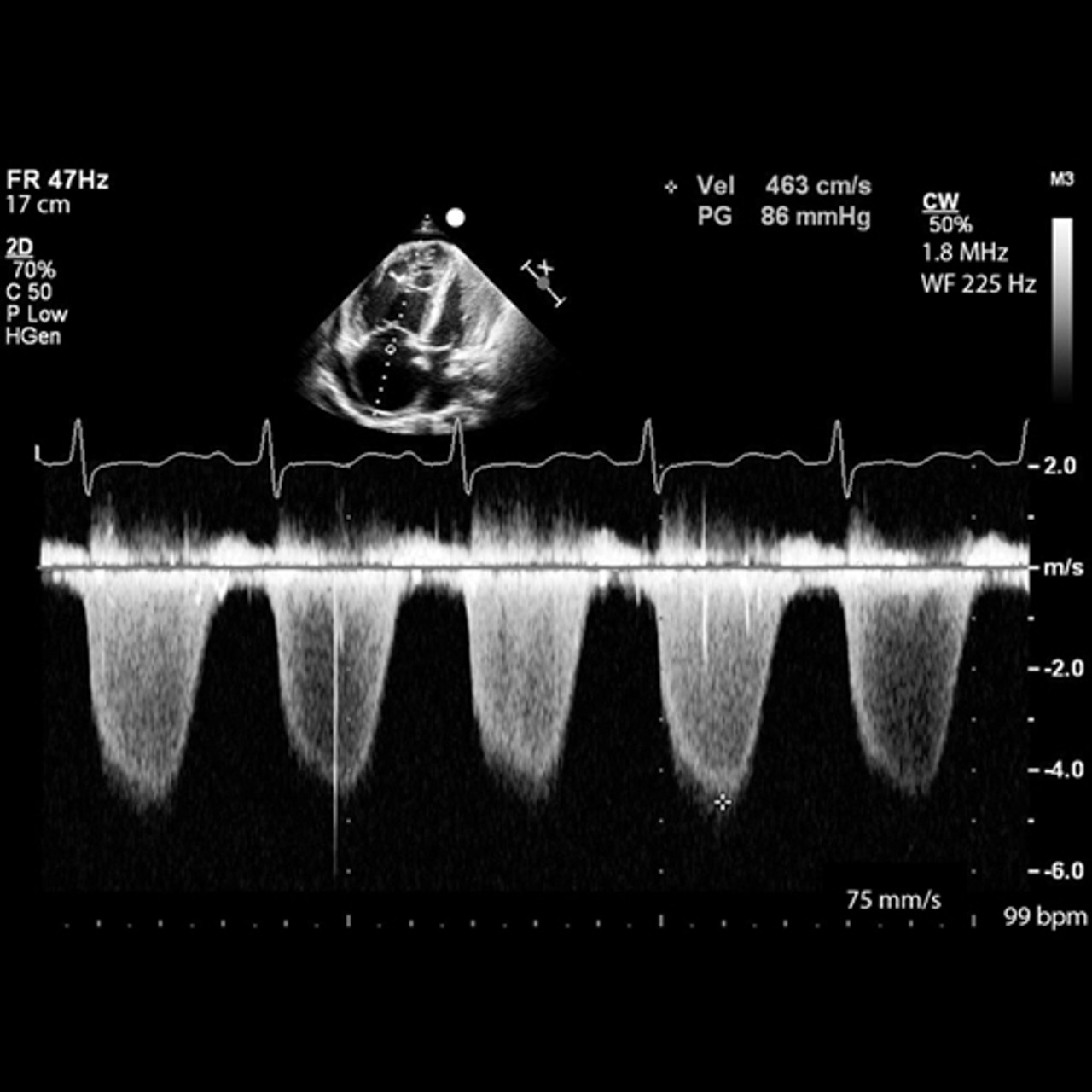 Ultrasound Physics and Technical Facts for the Beginner