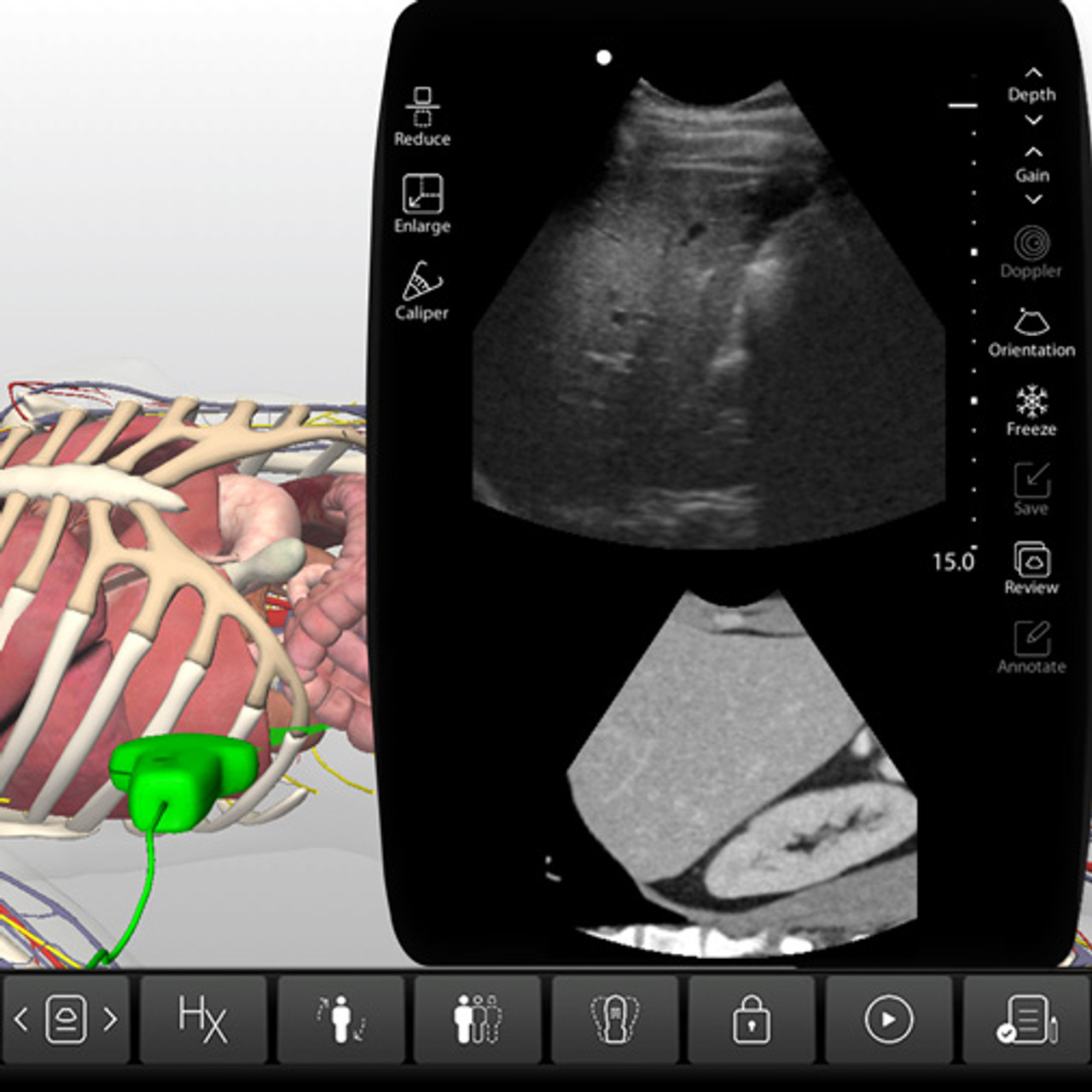 liver ultrasound anatomy