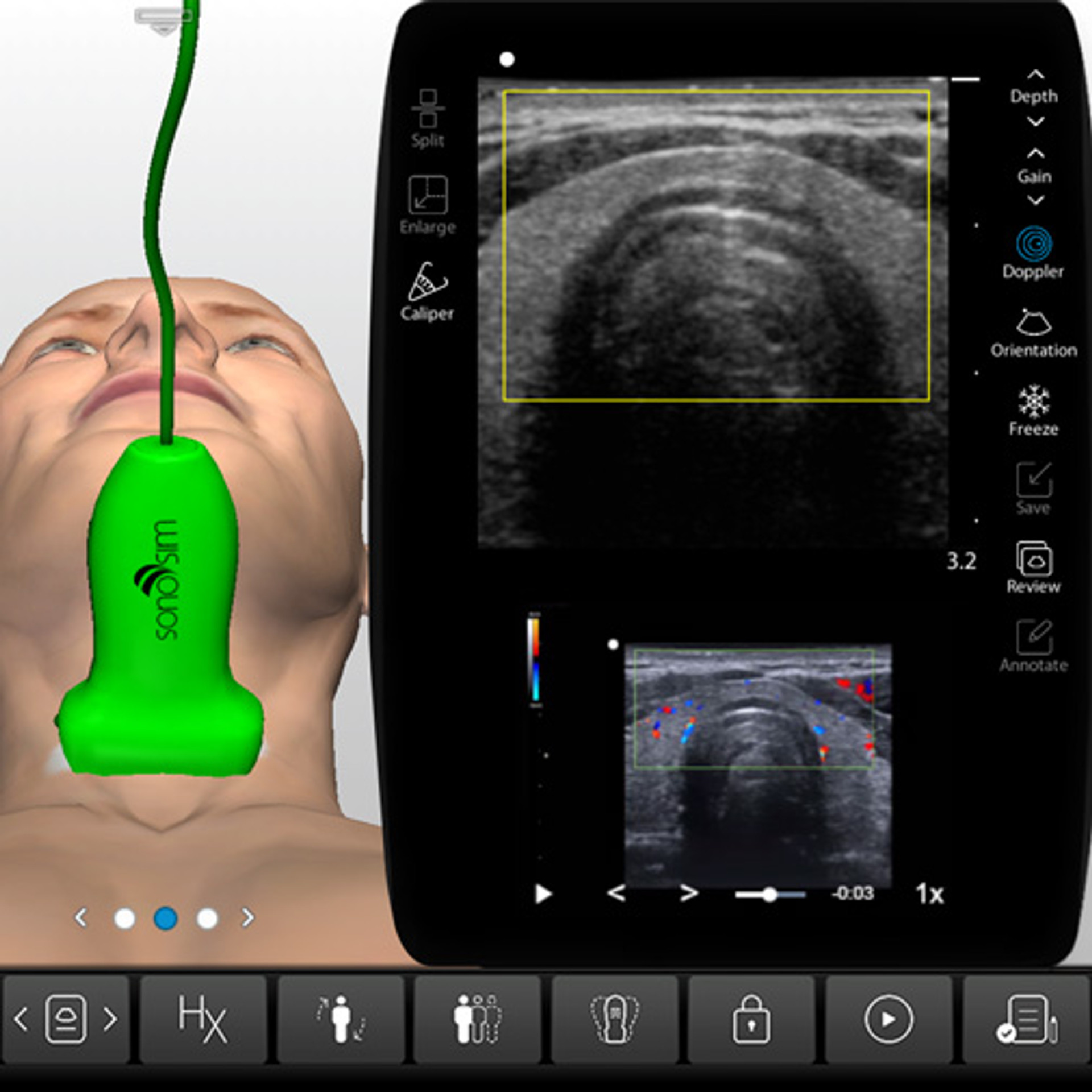 Thyroid Ultrasound Cpt 54