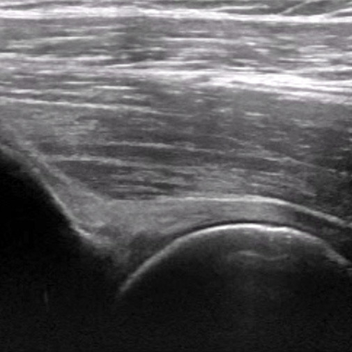 Soft Tissue Ultrasound - Clinical Ultrasound Training for Soft Tissue