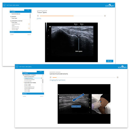Soft Tissue Ultrasound - Clinical Ultrasound Training for Soft Tissue