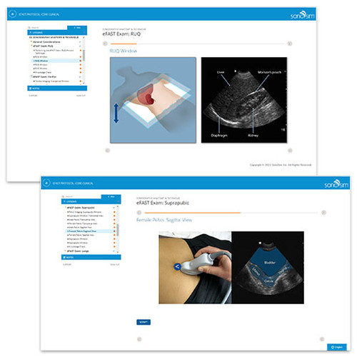 Clinical Ultrasound Training - eFAST Ultrasound Exam