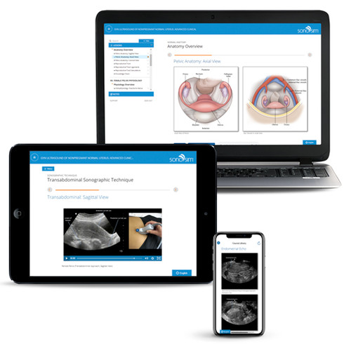 GYN Ultrasound Uterus - Clinical Ultrasound Training