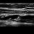 Peripheral venous access ultrasound training - SonoSim