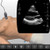 Heart ultrasound - Scan real patient heart anatomy in the SonoSimulator