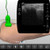 Hip ultrasound - scan hip anatomy - SonoSimulator