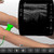 Ultrasound Training - Knee Anatomy - SonoSimulator