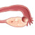 GYN Nonmalignant Ovarian Cysts Ultrasound Training - SonoSim