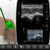 Practice biceps tendon sheath injection on a laptop - ultrasound training