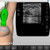 Breast Ultrasound Training | SonoSim