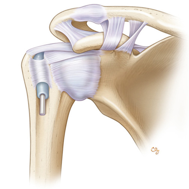 Shoulder Ultrasound Course