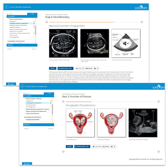 Basic Obstetric Ultrasound Course POCUS OB 6 Step