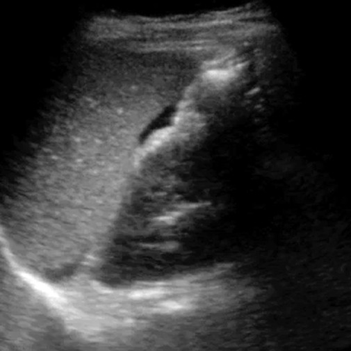 Ultrasound Training - FAST Ultrasound