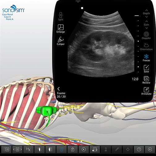 Renal Ultrasound - Online Clinical Renal Ultrasound Course