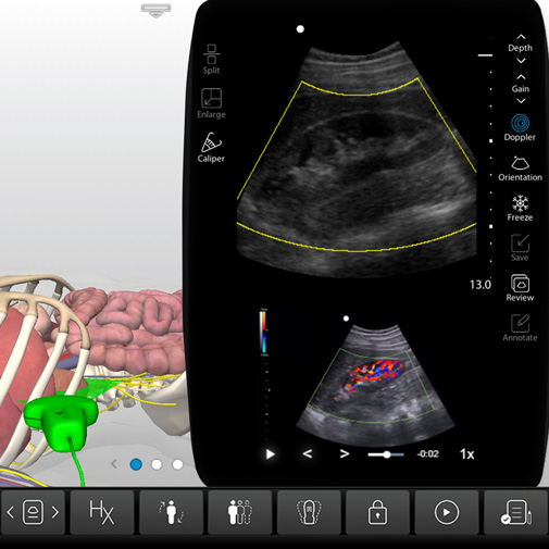 Renal Anatomy Ultrasound - Kidney, Ureters Ultrasound Training