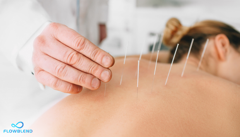 Nicotine Alternatives - Acupuncture