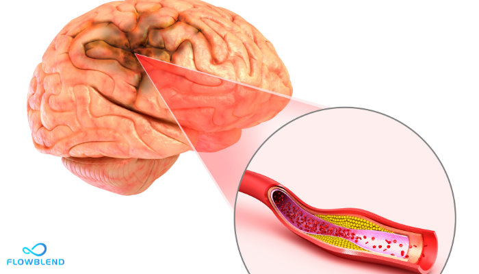 Science Of Nicotine And Addiction - Stroke