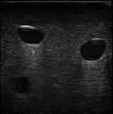 IN-0012615