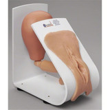 Replacement for 160-1932 (for AED) and others