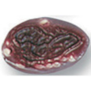 1st 2nd and 3rd Degree Burns Non-bleeding Moulage Replacement