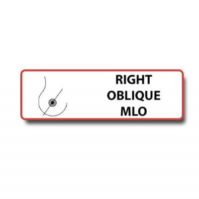 RIGHT OBLIQUE MLO Permanent Adhesive Label Replacement