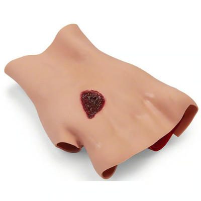 Phosphorous Burn Hand Medical Training Manikin Model Replacement
