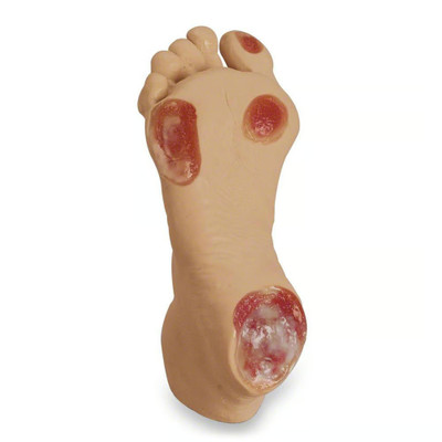 Pressure Ulcer Prevention LED Foot Care Light Therapy Device Replacement