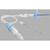 Emergency Pneumothorax Set 8.5fr