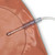 SUCKING CHEST WOUND Replacement