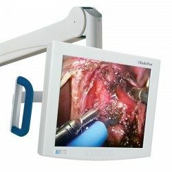 ENDOSCOPY VISUALIZATION