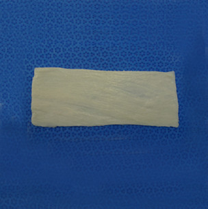 Fascia Lata Soft Tissue Graft
