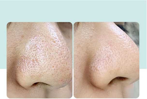 Pore Tightening Serum