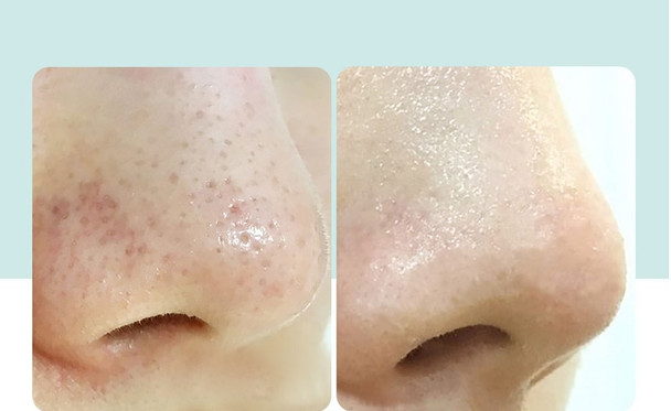 Minimizes Pores: Experience reduced pore size for a refined and flawless look, irrespective of your skin type.