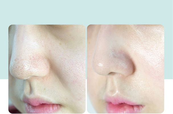 Pore Tightening Serum