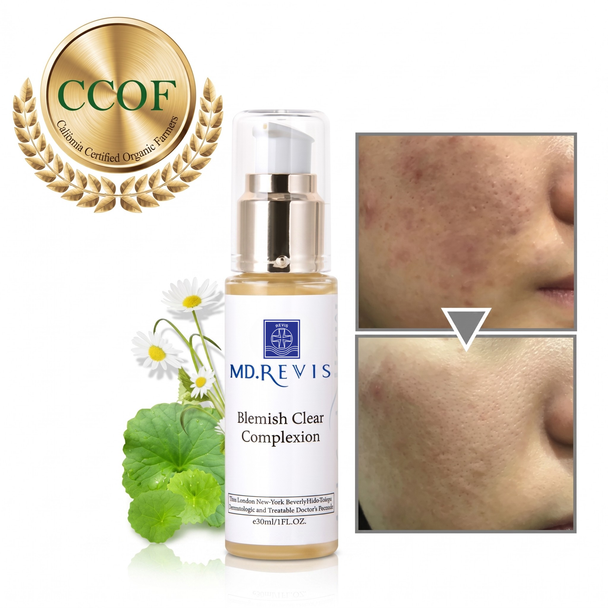 Organic Blemish Clear Complexion