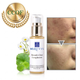 Organic Blemish Clear Complexion