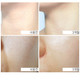 MD REVIS One Repair Cream 50g