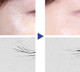 Say goodbye to sagging skin and fine lines.