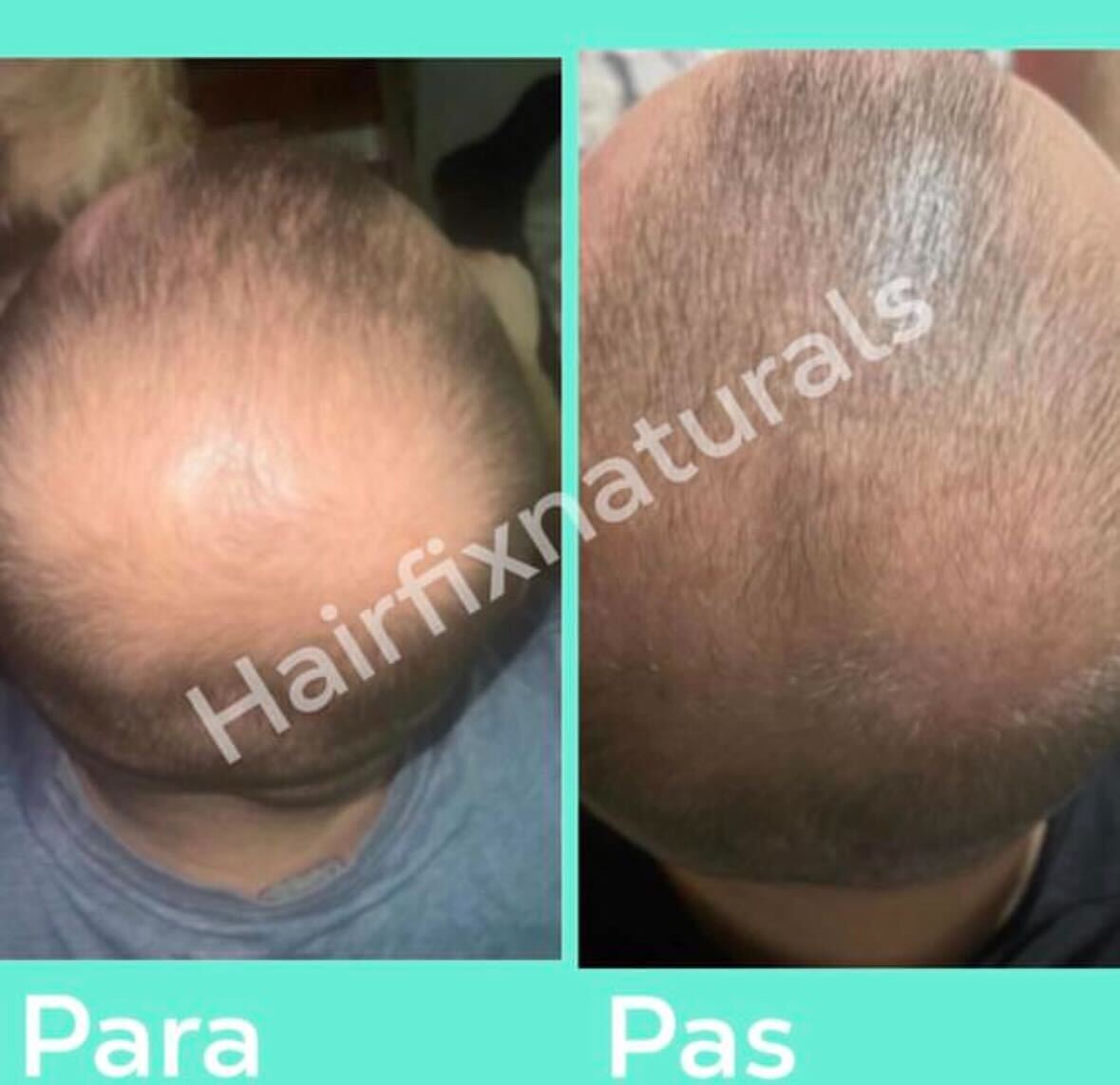 Male scalp before and after