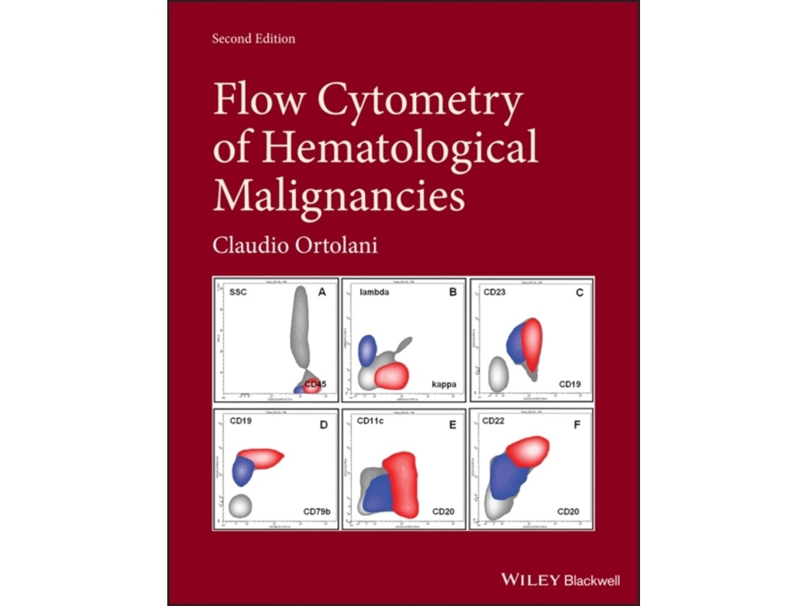 Flow cytometry of hematological malignancies de C Ortolani (Inglés)